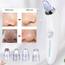 Blackhead Remover - Apnamart